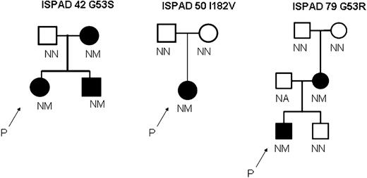 Figure 1. Diabetes status and mutations in the gene encoding Kir6.2 in three families. These partial pedigrees show families with G53S, G53R and I182V mutations. In all pedigrees, spontaneous mutations explain the absence of diabetes in the parents and its presence in a child. Squares represent males, and circles represent females. Filled circles and squares represent persons with diabetes. A two-letter code for allele status is shown underneath each symbol: M denotes mutation, N no mutation and NA not available for testing. P and an arrow denote the proband in each family (the first affected member recruited for this study). Amino acids are denoted by their single-letter codes.