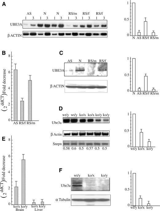 Figure 1. UBE3A expression on the transcriptional and translational level in the brain of RS patients and MeCP2 deficient mice. (A) Semi-quantitative RT–PCR results (a representative experiment). Aliquots of 1 and 3 µl cDNA were used to analyze UBE3A mRNA levels by RT–PCR (see Materials and Methods) in brains of AS patient (AS), normal individuals (N), RS male and female patients (RS/m and RS/f, respectively). UBE3A band intensities were normalized to β-actin. Right panel is a histogram of combined results of four different RT–PCR analyses. (B) The same brain RNA samples and M10 and M12 RNA (see Material and Methods) were analyzed by real-time PCR and expressed as fold decrease (2−ddCT) with respect to normal brain sample. (C) Protein extracts prepared from the brain of an AS patient (AS), normal individual (N), RS male patient (RS/m) and RS female patient (RS/f) were subjected to anti-UBE3A and anti-β-actin. Histograms on the right represent combined results of four different western blot experiments. The UBE3A band intensities were normalized to β-actin. (D) RT–PCR analysis was performed on mouse brain RNA samples of each normal (wt/y), heterozygote female (ko/x) and MeCP2-null (ko/y) mice. PCR products were analyzed as described in the Materials and Methods. Histogram on the right represents combined results of five different experiments performed with five different litters of newborns. (E) Results of real-time PCR analysis of the same samples are expressed as fold decrease (2−ddCT) with respect to normal brain or liver. (F) Brain extracts of wild-type (wt/y), heterozygote female (ko/x) and MeCP2-null (ko/y) mice were subjected to western blot analysis. Ube3a band intensities were normalized to α-tubulin. Histogram on the right represents combined results performed on three different mouse litters.
