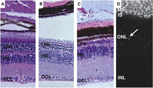 Figure 3. Hematoxylin–eosin staining of Mkks−/− (A–C) mouse retinas. Mice were examined at 2–3 months of age (A), 4–5 months (B) and 6 months (C). Some degenerative changes in the outer nuclear layer (ONL) are apparent in 2- to 3-month-old mice, although inner and outer segments are clearly distinguishable. By 5 months of age (B), the distinction between inner and outer segments is less apparent and the outer nuclear layer is significantly thinner than in Mkks+/+ eyes. At 6 months of age (C), the outer nuclear layer has largely degenerated and no inner or outer segments are present. Anti-rhodopsin staining is present in the outer segment by 2 months of age (D). IS, inner segments; OS, outer segments; INL, inner nuclear layer; GCL, ganglion cell layer.