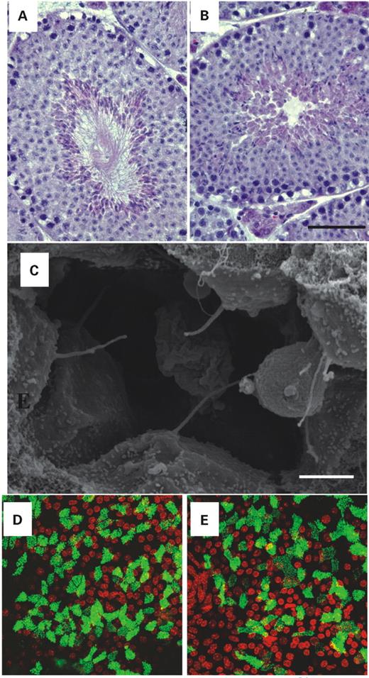 Figure 4. Cilia containing structures in Mkks−/− mice. Sections through the seminiferous tubules of wild-type (A) and Mkks−/− (B) mice reveal that mice deficient in the MKKS gene fail to produce normal flagella (Hematoxylin–eosin stain, scale bar=90 µm). Scanning electron microscopy of the renal distal tubule (C) of Mkks−/− mice reveals normal formation of renal cilia. Scale bar=2 µm. Projected Z-series of cultured tracheal epithelial cells of wild-type (D) and Mkks−/− (E) mice following differentiation with an air–fluid interface. The morphology of the cilia in the Mkks−/− mice is similar to that of wild-type mice. Cells were labeled with an antibody directed against β-tubulin-IV to visualize microtubule (green). Nuclei were counter-stained with TO PRO3 (red).