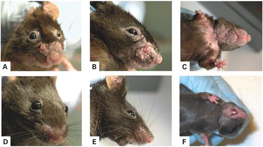 Figure 1. Phenotype of K5-(S249C)FGFR3 transgenic mice. (A and B) Two K5-(S249C)FGFR3 transgenic mice (line 79) at 6 months of age. These mice exhibit verrucous cauliflower-like lesions on the snout and the eyelids. These lesions are well demarcated, of symmetrical localization and occasionally display partial pigmentation, as shown in (B). (C) Throat and upper chest skin lesions on a 10-month-old K5-(S249C)FGFR3 transgenic mouse (line 79) are shown. The throat lesions resemble those on the snout in (A and B), areas of flat skin thickening with hair loss are clearly apparent on the upper chest. (D–F) Control littermates are shown below each transgenic mouse.