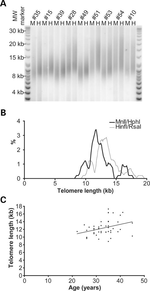 Figure 1. TRF analysis of human male germline. (A) Representative TRF Southern blot; each individual is analysed in duplicate, H, HinfI/RsaI; M, MnlI/HphI and the DNA resolved by FIGE. (B) Telomere length distribution, thin line represents HinfI/RsaI data mean 13.57±1.99 kb (SD), the thick line represents MnlI/HphI 12.48±2.00 kb (SD). (C) MnlI/HphI TRF estimates plotted as a function of age, with regression line showing a slope of +135 bp/year, correlation coefficient r=0.34, P<0.02, n=47.