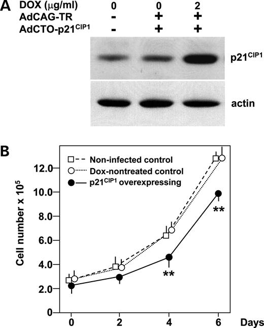 Figure 6. Decrease in MIN6 cell numbers in response to forced p21 CIP1 expression. ( A ) Forced expression of p21 CIP1 in MIN6 cells. Cells were either uninfected or infected with AdCAG-TR (m.o.i. of 30) and AdCTO-p21 CIP1 (m.o.i. of 100) harboring p21 CIP1 cDNA. Expression of p21 CIP1 was induced by 48 h DOX (2 µg/ml) treatment. MIN6 cell lysates were subjected to immunoblot analysis using anti-p21 CIP1 and actin antibodies. ( B ) Numbers of MIN6 cells overexpressing p21 CIP1 . One day after adenovirus transduction, cells were reseeded (2×10 5 per well) and divided into two groups, and, after two more days, treatment with (closed circles) or without (open circles) DOX (2 µg/ml) was commenced (day 0). Uninfected MIN6 cells (open squares) were also seeded 2 days before. Cells were then harvested on days 0, 2, 4 and 6, stained with trypan blue and counted. Data are means±S.E. for triplicate wells. ** P <0.01 against both controls. The experiment was repeated three times and similar results were obtained. 