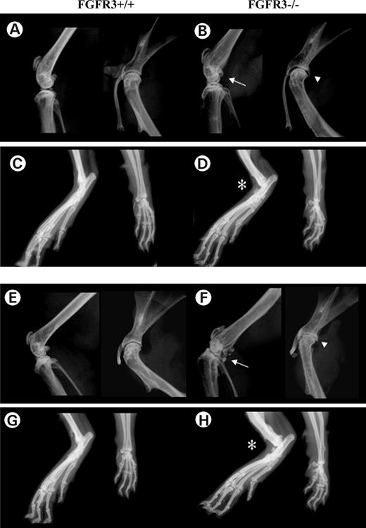 Figure 1. X-ray analysis of joints at 4 and 12 months in Fgfr3+/+ and Fgfr3−/− mice. High resolution Faxitron X-rays of the knees (A, B, E and F left), shoulder joints (A, B, E and F right) and paws (C, D, G and H) of Fgfr3+/+ and Fgfr3−/− mice at 4 months (A–D) and 9 months (E–H) of age. Arrows and arrowheads show progressive joint destruction and asterisks show soft tissue swelling in the Fgfr3−/− mice. Images captured at ×2 magnification and are representative of 8–10 mice of each genotype at each age.