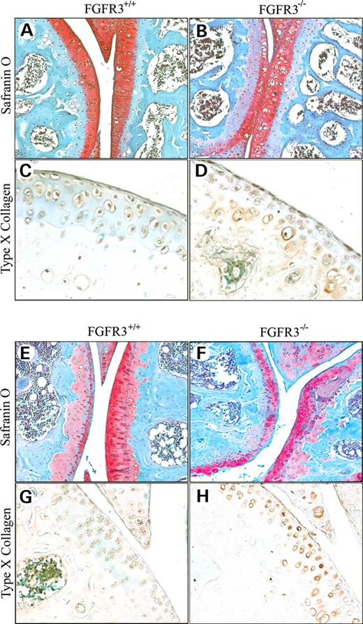 Figure 3. Histochemical and immunochemical staining for proteoglycan and type X collagen. The knee joints of Fgfr+/+ and Fgfr3−/− mice at 4 months (A–D) and 9 months (E–H) of age were decalcified, embedded in paraffin and stained with Safranin-O to identify proteoglycan (A, B, E and F) or immunostained to identify type X collagen (C, D, G and H). Articular cartilage in the distal femur and proximal tibia in Fgfr3−/− mice showed an increase in cell number and large lacunae at 4 months (B) and a reduction in cell number and proteoglycan content at 9 months (F). Type X collagen immunoreactivity was seen in the articular cartilage of Fgfr3−/− mice at 4 and 9 months (D and H) but not in that of Fgfr3+/+ mice (C and G). Results are representative of those obtained from five mice of each genotype at each age. Magnification at source ×20.