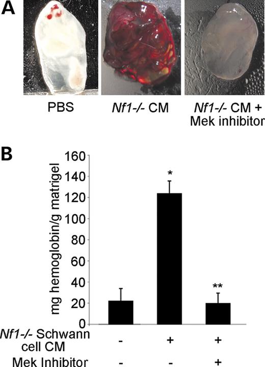 Figure 6. Effect of Mek inhibition on the angiogenic response of Nf1+/− mice to Nf1−/− SCCM. (A) Photomicrographs of matrigel plugs containing either Nf1−/− SCCM or PBS in the presence or absence of 50 µm PD98059 harvested from Nf1+/− mice. The bloody appearance of the matrigel plug is a qualitative representation of the in-growth of blood vessels in response to the angiogenic stimuli (VEGF or bFGF). Results are representative of five independent experiments. (B) Quantification of the angiogenic response of Nf1+/− mice to insertion of matrigel plugs containing either PBS or Nf1−/− SCCM in the presence or absence of 50 µm PD98059. Results are expressed in milligrams of hemoglobin/gram of matrigel±SEM. *P<0.004 for Nf1+/− with a PBS plug versus Nf1+/− with Nf1−/− SCCM plugs (n=5); **P<0.003 for Nf1+/− with Nf1−/− SCCM plugs versus Nf1+/− with Nf1−/− SCCM and PD98059 plugs by a Student's paired t-test (n=5).
