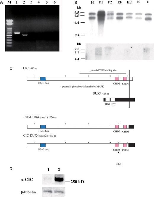 Detection of the CIC–DUX4 chimeric transcripts and the deduced structure of the chimeric proteins. (A) RT–PCR analysis of the t(4;19) tumors. CIC–DUX4 fusion transcripts were detected in two cases (lanes 1 and 2 with CIC4120 and DUX4RTr2 primers), whereas no reciprocal DUX4–CIC fusion was seen (lanes 3 and 4 with DUX4RTf1 and CICFL3 primers). Lanes 1 and 3, case 1; lanes 2 and 4, case 2 sample. M, a 100 bp ladder DNA size marker. (B) Northern blotting. Top. Aberrant large-sized signals of CIC were observed in P1 and P2 cases of t(4;19) tumors. H, HeLa cell; EF, Ewing's sarcoma with the EWS–FLI1 fusion; EE, Ewing's sarcoma with the EWS–ERG fusion; K, clear cell sarcoma with the EWS–ATF1 fusion; U, U2OS cell. Bottom. The same blot was hybridized with the DUX4 cDNA probe. Signals of same molecular size were seen in P1 and P2. Molecular sizes are indicated in kilobases. (C) Deduced structure of the CIC–DUX4 protein. CHD, Capicua homology domains; HD, homeodomain; NLS, nuclear localization signal. Putative MAPK phosphorylation sites are indicated with dots. (D) Immunoblotting for CIC–DUX4. 1, U2OS; 2, ECD1. CIC–DUX4 is detected by using an anti-CIC serum. Weak expression of the wild-type CIC is shown in U2OS cells. The anti-β-tubulin was used as control.