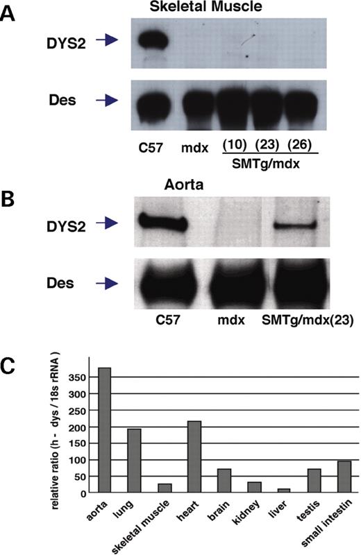  Dystrophin expression in SMTg/mdx mice. ( A – B ) Western blotting analysis was performed on protein extracts from TA muscles and aorta using a C-terminal specific dystrophin antibody (DYS2). The arrows indicate the 427 kDa dystrophin (DYS2) and the 50–55 kDa desmin (Des). Dystrophin expression was detectable only in TA muscle of C57BL/10 mice (A) and in aorta of C57BL/10 and SMTg/mdx mice, but not in mdx mice (B). Des was used as a loading control. ( C ) Semi-quantitative real-time RT-PCR shows that dystrophin mRNA expression was high in tissues containing abundant smooth muscle, but low in skeletal muscle. 