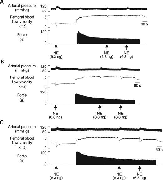  Vasoconstrictor responses to intra-arterial injection of the α-adrenergic agonist NE in resting and contracting hindlimbs. ( A – C ) Segments of original records from experiments in a C57BL/10 (A), SMTg/mdx (line 23) (B) and mdx (C) mouse showing the increases in arterial blood pressure and decreases in FBFV in response to NE. The robust vasoconstrictor responses to NE that were observed in the resting hindlimbs of all three mice were attenuated in the contracting hindlimbs of the C57BL/10 mouse and to a lesser degree in the SMTg/mdx mouse, but not in the mdx mouse. 
