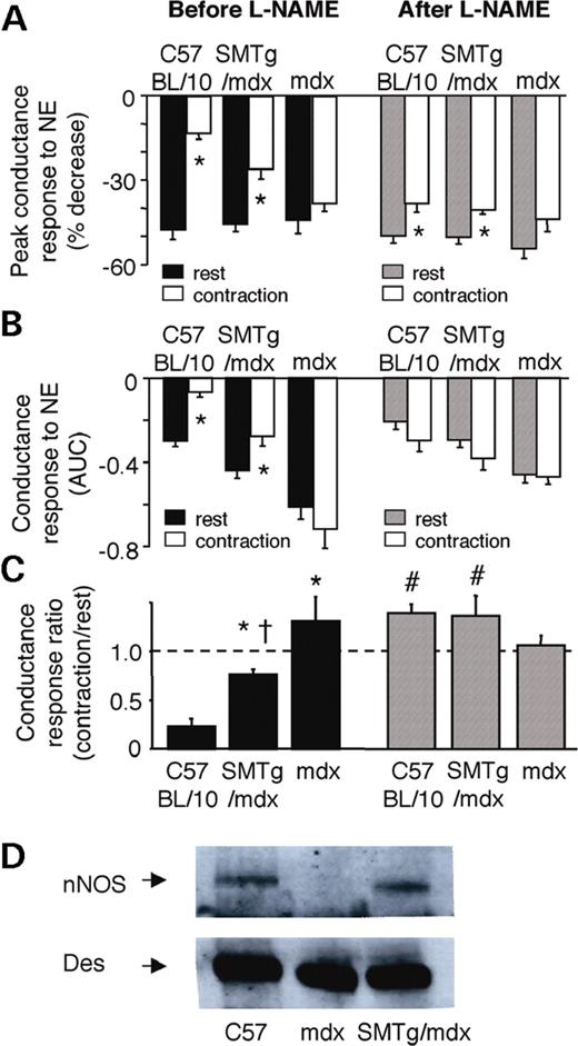  Effects of NOS inhibition on NE-mediated vasoconstriction and nNOS expression in SMTg/mdx mice. ( A and B ) Decreases in FVC evoked by NE in resting and contracting hindlimbs before and after treatment with L-NAME. Responses are expressed as peak changes (A) or as integrated changes (B). * P <0.05 versus rest; AUC, area under the curve. ( C ) Compared with the baseline responses (black bars), treatment with the NOS inhibitor L-NAME (hatched bars) significantly enhanced the vasoconstrictor responses to NE in the contracting hindlimbs of the C57BL/10 and SMTg/mdx mice, but not in the mdx mice. * P <0.05 versus C57BL/10; †P <0.05 versus mdx; #P <0.05 versus before L-NAME; C57BL/10, n =7; SMTg/mdx, n =11; mdx, n =8. ( D ) Western blot analysis showing that nNOS is expressed in aorta of C57BL/10 and SMTg/mdx mice (line 23), but not in mdx mice. Des was used as a loading control. 