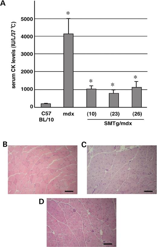  Skeletal muscle pathology in the SMTg/mdx mice. ( A ) Serum CK levels of 1-year-old SMTg/mdx mice were significantly lower than those of age-matched mdx mice ( n ≥7 each group). * P <0.01 for comparisons between mdx and each line of SMTg/mdx. ( B – D ) Sections of TA muscles from a 1-year-old C57BL/10 (B), SMTg/mdx (line 23) (C), and mdx (D) mouse stained with H&E. There were no discernible histological differences between TA muscles of the SMTg/mdx and mdx mice, both of which had a predominant number of fibers with centralized nuclei. Scale bar: 100 µm. 