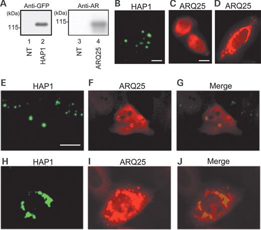  Expression of HAP1 and/or AR after single- or cotransfection of cDNAs of GFP-HAP1 and FLAG-ARQ25 into HEp-2 cells in the control (DHT undetectable) medium. ( A ) Western blots with an anti-GFP (left) antibody or anti-AR (N20) (right) antibody for extracts (15 µg) from non-transfected (NT: lanes 1 and 3), GFP-HAP1-transfected (Lane 2) and ARQ25-transfected (Lane 4) cells. Molecular weight (kDa) is indicated in the left of each panel. ( B ) A fluorescent photomicrograph showing subcellular HAP1 expression (GFP: green) in HAP1-transfected cells. Note that HAP1 forms dot-like structures in the cytoplasm (bar=10 µm). ( C and D ) Fluorescent photomicrographs showing subcellular ARQ25 expression (Alexa594: red) in ARQ25-transfected cells. ARQ25 was detected with Alexa594-conjugated secondary antibodies following incubation with an anti-AR antibody (N20). Note that ARQ25 is diffusely present in the cytoplasm (and some are present in the nucleus) (C) or assembled into a huge mass of aggregations in perikarya (D) (bar=10 µm). ( E – J ) Fluorescent photomicrographs showing the subcellular expression of HAP1 (GFP: green) and ARQ25 (Alexa594: red) after cotransfection of their cDNAs. Note that merged images show the colocalization of HAP1 and ARQ25 as ring-shaped solitary cytoplasmic inclusions (E, F and G) or a huge mass of aggregations in perikarya (H, I and J) (bar=10 µm). 