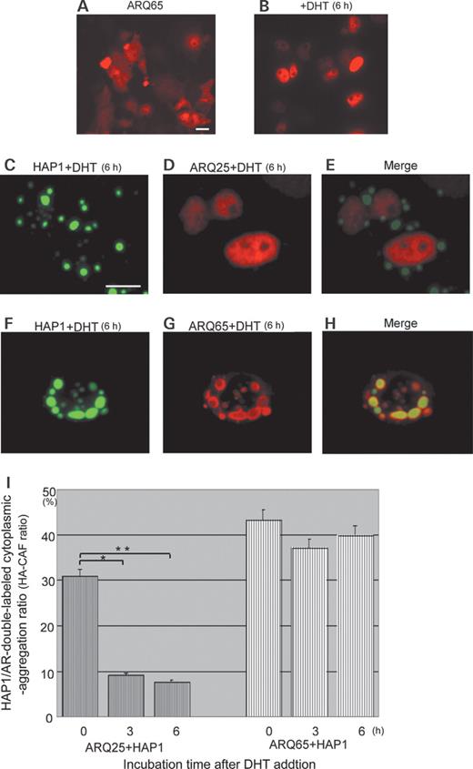  Effects of androgen on subcellular interaction between HAP1 (GFP: green) and ARQ25 or ARQ65 (Alexa594: red) in the cotransfected HEp-2 cells ( A and B ) Fluorescent photomicrographs showing that diffused cytoplasmic ARQ65 is translocated into the nucleus 6 h after DHT administration (10 −6   M ) (bar=10 µm). ( C – E ) Fluorescent photomicrographs showing that the HAP1/ARQ25 complex is dissociated 6 h after DHT administration (10 −6   M ). Note that ARQ25 is translocated into the nucleus, whereas HAP1 remains as a cytoplasmic inclusion (bar=10 µm). ( F – H ) Fluorescent photomicrographs showing persistence of the HAP1/ARQ65 complex even 6 h after DHT administration. Note that HAP1 and ARQ65 stay colocalized in most of the cytoplasmic inclusions (bar=10 µm). ( I ) Bar graph comparing HA-CAF ratios in time course between ARQ25 and ARQ65 (0, 3 and 6 h) after DHT administration (10 −6   M ). Note that the HA-CAF ratio after DHT administration is kept stable in the case of ARQ65+HAP1 when compared with that of ARQ25+HAP1 showing the prominent decrease in time course. Asterisks indicate statistical difference in HA-CAF ratios of ARQ25 between 0 and 3 h ( P <0.05) and between 0 and 6 h. 