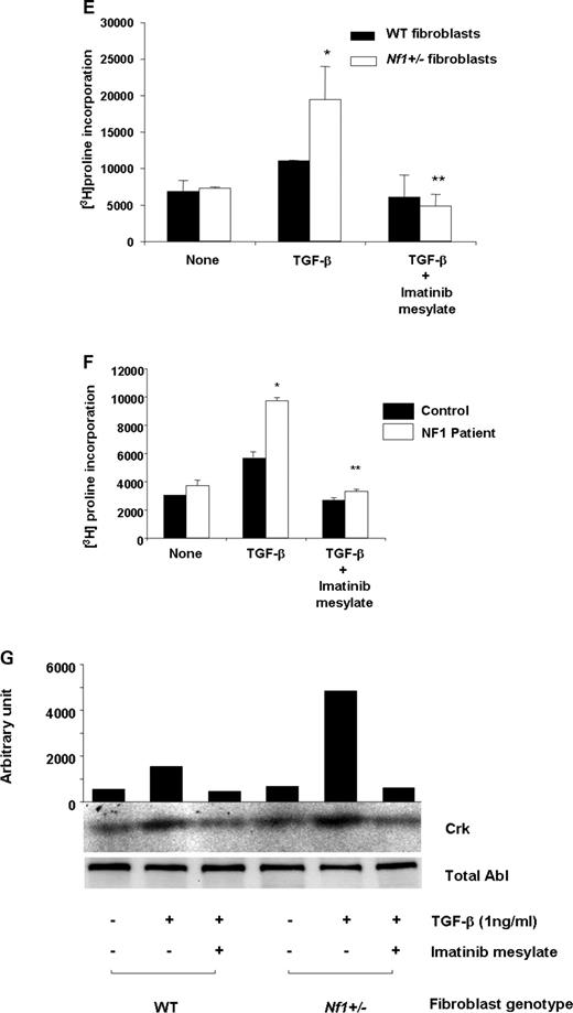 Effect of c-abl activation on Nf1+/− fibroblast function. (A) WT and Nf1+/− fibroblasts were stimulated with TGF-β and c-abl activity was examined using a kinase assay. Left panel: data are representative of one of four independent experiments using different primary cell lines. Right panel: mean activation of c-abl in WT and Nf1+/− fibroblasts (n=4). (B) Nf1+/− and WT fibroblasts were transduced with the indicated retroviral constructs and TGF-β-mediated c-abl activity was examined. Results are representative of one of four independent experiments. (C) Nf1+/− and WT fibroblasts were transfected with siRNAs to c-abl or with scramble siRNA sequences, and 48 h following transfection, western blotting was performed to measure endogenous c-abl. (D) Nf1+/− and WT fibroblasts were transfected with siRNA sequences to c-abl, scramble siRNA sequences or the vehicle, then stimulated with TGF-β, and [3H]proline incorporation was measured. Results show the mean±SEM from five independent experiments. *P<0.01 comparing proline incorporation of Nf1+/− fibroblasts with vehicle or scramble siRNA to Nf1+/− fibroblasts containing c-abl siRNA. (E) Nf1+/− and WT fibroblasts were cultured in the presence of TGF-β and imatinib mesylate or TGF-β and the vehicle for 24 h prior to measuring proline incorporation. Results represent mean±SEM from one of five independent experiments. *P<0.001 comparing Nf1+/− fibroblasts with WT fibroblasts following TGF-β stimulation. **P<0.001 comparing Nf1+/− fibroblasts treated with TGF-β versus Nf1+/− fibroblasts treated with TGF-β and imatinib mesylate. In five independent experiments, TGF-β mediated a 2.1±0.3-fold increase in [3H]proline incorporation of Nf1+/− fibroblasts compared with WT fibroblasts and increased incorporation was inhibited by imatinib mesylate. (F) Human fibroblasts from neurofibromas or normal donors were stimulated with TGF-β±imatinib mesylate. *P<0.001 comparing Nf1+/− fibroblasts with WT fibroblasts following TGF-β stimulation. **P<0.001 comparing fibroblasts from an NF1 patient treated with TGF-β versus NF1 patient derived fibroblasts treated with TGF-β and imatinib mesylate. (G) Nf1+/− and WT fibroblasts were stimulated with TGF-β±imatinib mesylate and c-abl activity was measured. Data are representative of one of three independent experiments with similar results. (H) Nf1+/− mast cells and fibroblasts were admixed in three-dimensional collagen lattices together with imatinib mesylate or the vehicle. Matrix contraction was measured 24 h after initiation of cultures. Data represent mean±SEM of five independent experiments with similar results. *P<0.01 comparing collagen contraction of Nf1+/− fibroblasts with WT fibroblasts incubated with WT mast cells. **P<0.01 comparing collagen contraction of Nf1+/− fibroblasts with WT fibroblasts incubated with TGF-β. ***P<0.001 comparing collagen contraction of cultures containing imatinib mesylate added to the cultures with genotypic equivalent cultures incubated in the vehicle. (I) Representative collagen lattices of the indicated genotypes and experimental treatments.