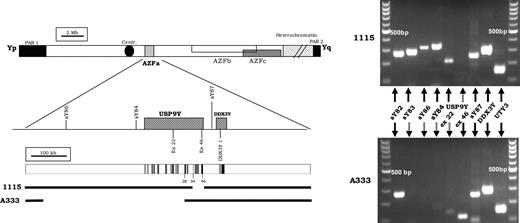 Intragenic deletion of the USP9Y gene in patient 1115/0 and A333. PCR amplifications with the standard AZFa markers are shown on the right side of the figure. Schematic representation of the Y chromosome, including the three AZF regions. STS markers used for the routine screening and the two AZFa genes (USP9Y and DDX3Y) with their exon/intron structure are shown and reported to scale. Coding exons in black. The extent of the deletions are shown as a gap (shown to scale).