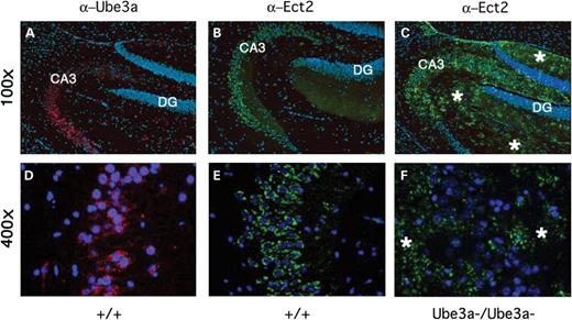 Ect2 protein expression patterns are altered in the brains of Ube3a−/− null mice. Immunohistochemistry was performed on serial paraffin sections from formalin fixed brains isolated from wild-type (A, B, D and E) or Ube3a−/− littermate mice (C and F) using α-Ube3a (red) or α-Ect2 (green) antisera and counterstaining with DAPI (blue). Images were captured at either low (100×; A–C) or high power (400×; D–F). (A and D) Ube3a is expressed in a perinuclear staining pattern in wild-type neurons of the CA3 region of the hippocampus (DG is also labelled for reference). (B and E) A similar perinuclear staining pattern was observed for Ect2 in the wild-type hippocampus. Ube3a and Ect2 appear to be expressed in the same cellular layers and regions of the hippocampus. (C and F) Ect2 expression was mis-localized in the hippocampus of Ube3a-null animals (compare with B and E in regions with asterisks). In addition, Ect2 could be detected ectopically in layers adjacent to the hippocampus that may reflect a shift in Ect2 localization from the neuronal body in wild-type mice to an axonal and dendritic location in mutant mice (asterisks). (G–J) Cerebellar expression of Ube3a (G and I) and Ect2 (H and J) in wild-type (G and H) and Ube3a null (I and J) mice. Sections were counterstained with methyl green to identify nuclei. Abbreviations are as follows: GL, granule cell layer; PL, Purkinje cell layer; and ML, molecular cell layer. Both Ube3a and Ect2 proteins are detected in the cytoplasm of Purkinje cell neurons in wild-type mouse brain (G and H). In wild-type mice, Ube3a staining was predominantly confined to the cytoplasm of Purkinje cells (G), whereas Ect2 staining was also detected in the nucleus (H). In contrast, in Ube3a null mice Ect2 expression was up-regulated in the intervening space between granule cells, which contains mossy fibers of the granule cell layer and Purkinje cells axons, whereas expression was greatly reduced in the cytoplasm of the Purkinje cell bodies compared with wild-type controls. In the null mice, Ect2 expression was also elevated above wild-type levels within the molecular layer into which the Purkinje cells send their elaborate dendritic arbors (J). No Ube3a staining was detected in either the granule cell layer or the Purkinje cells in the Ube3a null mice (I).