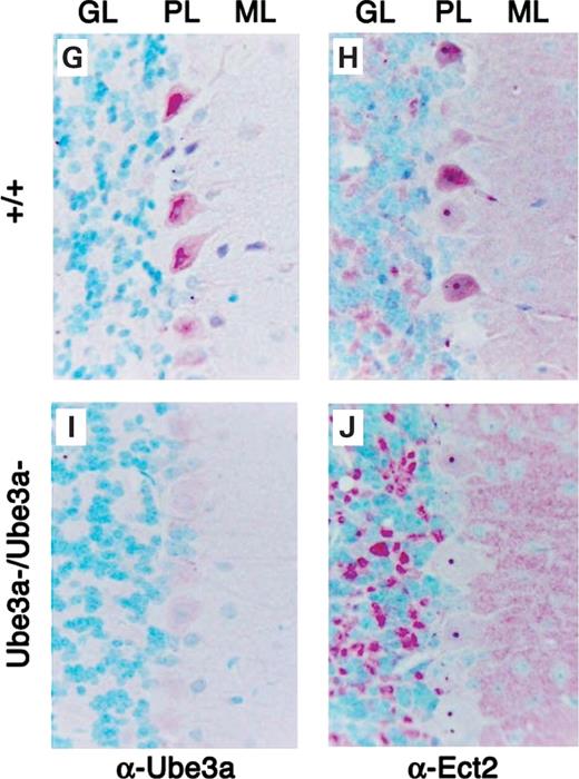Ect2 protein expression patterns are altered in the brains of Ube3a−/− null mice. Immunohistochemistry was performed on serial paraffin sections from formalin fixed brains isolated from wild-type (A, B, D and E) or Ube3a−/− littermate mice (C and F) using α-Ube3a (red) or α-Ect2 (green) antisera and counterstaining with DAPI (blue). Images were captured at either low (100×; A–C) or high power (400×; D–F). (A and D) Ube3a is expressed in a perinuclear staining pattern in wild-type neurons of the CA3 region of the hippocampus (DG is also labelled for reference). (B and E) A similar perinuclear staining pattern was observed for Ect2 in the wild-type hippocampus. Ube3a and Ect2 appear to be expressed in the same cellular layers and regions of the hippocampus. (C and F) Ect2 expression was mis-localized in the hippocampus of Ube3a-null animals (compare with B and E in regions with asterisks). In addition, Ect2 could be detected ectopically in layers adjacent to the hippocampus that may reflect a shift in Ect2 localization from the neuronal body in wild-type mice to an axonal and dendritic location in mutant mice (asterisks). (G–J) Cerebellar expression of Ube3a (G and I) and Ect2 (H and J) in wild-type (G and H) and Ube3a null (I and J) mice. Sections were counterstained with methyl green to identify nuclei. Abbreviations are as follows: GL, granule cell layer; PL, Purkinje cell layer; and ML, molecular cell layer. Both Ube3a and Ect2 proteins are detected in the cytoplasm of Purkinje cell neurons in wild-type mouse brain (G and H). In wild-type mice, Ube3a staining was predominantly confined to the cytoplasm of Purkinje cells (G), whereas Ect2 staining was also detected in the nucleus (H). In contrast, in Ube3a null mice Ect2 expression was up-regulated in the intervening space between granule cells, which contains mossy fibers of the granule cell layer and Purkinje cells axons, whereas expression was greatly reduced in the cytoplasm of the Purkinje cell bodies compared with wild-type controls. In the null mice, Ect2 expression was also elevated above wild-type levels within the molecular layer into which the Purkinje cells send their elaborate dendritic arbors (J). No Ube3a staining was detected in either the granule cell layer or the Purkinje cells in the Ube3a null mice (I).