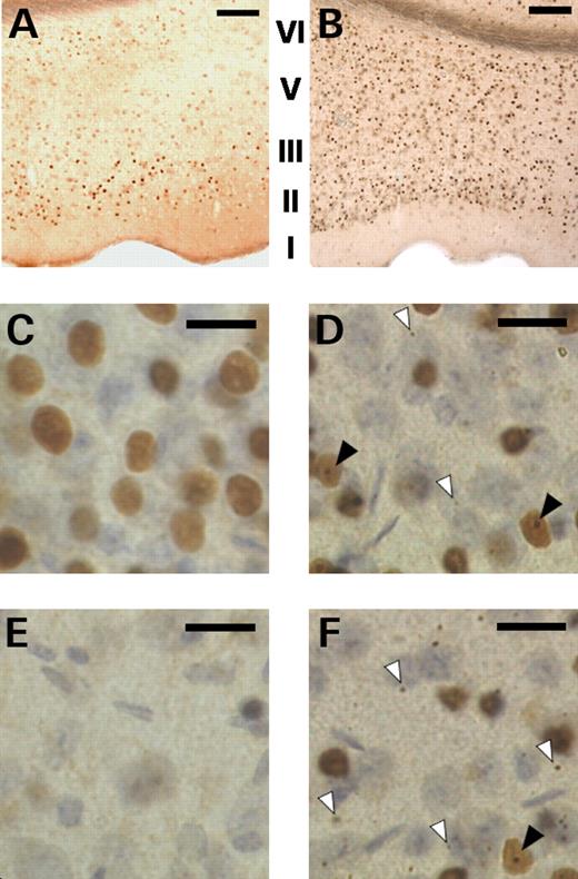 Mutant huntingtin expression in the perirhinal cortex is age- and layer-specific. (A and B) slices from 3 and 7 month-old transgenic mice respectively showing differential and regional-specific diffuse nuclear staining in the perirhinal cortex. (C and D) higher powered images of layers II/III taken at 3 and 7 months respectively; note the distinct pattern of immunostaining in the nuclei of the principal cells. (E and F) higher powered images of layers V/VI taken at 3 and 7 months respectively; note the near absence of nuclear staining at 3 months. At 7 months of age distinct nuclear inclusions (filled arrowheads) and micro-aggregates within the neuropil (open arrowhead) were observed in layers II/III (D) and layers V/VI (F). Scale bar: Images A and B (100× magnification) bar represents 250 µm; images C–F (400× magnification) bar represents 20 µm. Cortical layers I–VI indicated in images A and B; note the absence of layer IV in perirhinal cortex.