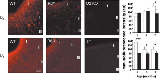Altered dopamine receptor expression in the R6/1 cortex. Top: D2 dopamine receptor levels, measured using immunofluoresence, were found to be reduced in layer I of the perirhinal cortex in R6/1 mice. Representative fluorescent (confocal) images prepared from 7-month-old non-transgenic (WT) and transgenic (R6/1) mice are shown together with material processed from a D2 dopamine receptor knock-out (D2KO) mouse. There is a clear reduction in immunofluoresence observed in the R6/1 section. No staining was seen in the perirhinal cortex of the D2KO mouse demonstrating specificity of the antibody used. Histograms show the detection levels of D2 dopamine receptors in layer I of the perirhinal cortex at 1, 3 and 7 months of age. There is a clear age-dependent increase in immunofluoresence in non-transgenic tissue, this increase is not maintained in R6/1. Bottom: D1 dopamine receptors also demonstrate an age-dependent reduction in expression levels. Representative images prepared from 7-month-old non-transgenic (WT) and transgenic (R6/1) mice are shown together with control material processed using only the secondary (IIO) antibody (indicating the relative specificity of the D1 antibody used). The histogram shows receptor detection at 1, 3 and 7 months. In non-transgenic perirhinal cortex, an age-dependent decrease in D1 dopamine receptor expression is seen. From the earliest age examined, D1 receptor levels in R6/1 cortex were reduced compared with controls. (*P<0.05; ***P<0.0001; Fisher LSD test). Images taken with a 40× objective; scale bar: 100 µm (D1 WT image). Cortical layers I–III as indicated (three animals used for each condition).