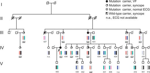 Pedigree of a large multi-generation family (generation I–V) with congenital LQTS and a C-terminal HERG mutation (R1014PfsX39). Haplotypes at the LQT2 locus (D7S483–D7S636) are shown; red bars indicate the chromosomal haplotype marker associated with the disease; other colored bars indicate markers unrelated to the disease. Males are shown as squares and females as circles. Values below symbols indicate QTc values (from lead II) in ms1/2 and were underlined when referring to mutation carriers. Dashed line on the right top of a symbol means ‘DNA not available for analysis’. The disease haplotype was found in nine individuals with a QTc prolongation (>440 ms1/2). In contrast to other individuals with borderline QTc values, they all suffered from syncope. The disease haplotype was also found in three individuals with normal QTc values (IV-16: 426 ms1/2, IV-17: 429 ms1/2, V-4: 430 ms1/2). In these cases, the mutation was identified retrospectively. Altogether, the disease haplotype was identified in 12 individuals, but the disease penetrance was incomplete (75%), because only nine patients had LQTS symptoms.