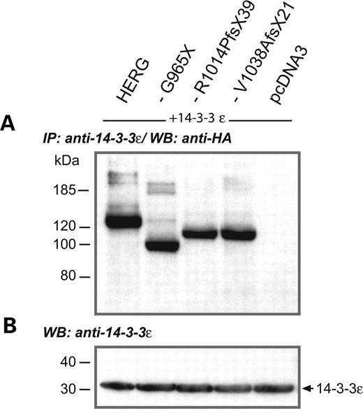 Interaction of 14-3-3ϵ with wild-type and mutant HERG subunits. (A) Immunoprecipitation (IP) of 14-3-3ϵ protein co-expressed with HA epitope-tagged wild-type or mutant HERG subunits as indicated on top of each lane, followed by immunoblotting (WB) and detection of HERG subunits with anti-HA antibodies, reveals that all subunits still interacted with 14-3-3ϵ, regardless of C-terminal truncation. Again, we observed a comparable pattern of immunoreactive bands for all subunits analyzed. (B) The amount of protein used in (A) was always adjusted to the levels of 14-3-3ϵ detected in a control immunoblot (WB) with anti-14-3-3ϵ antibodies. Size markers in kilodaltons are given on the left. Arrow indicates the molecular weight of 14-3-3ϵ.