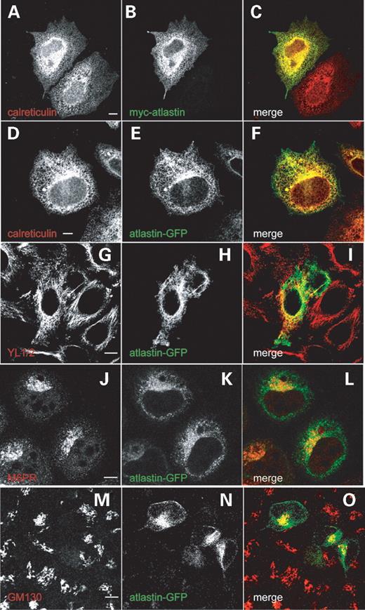 Figure 3. Epitope-tagged wild-type and mutant atlastin co-localize with ER and microtubule markers. The images show Hela cells labelled with the antibody marker shown in (A, D, G, J, M). (B, E, H, K, N) show the expression pattern in the same cells, transiently transfected with the construct shown in each panel. The colour of text in each of these panels represents the image colour in the corresponding merged panels (C, F, I, L, O). Both N-terminal myc-tagged (A–C) and C-terminal GFP-tagged (D–F) atlastin co-localize tightly with calreticulin. Wild-type atlastin also partially co-localizes with the microtubule marker YL1/2 (G–I). This co-localization was strongest in the perinuclear region. There is also partial co-localization with the late endosomal mannose-6-phosphate receptor (M6PR) (J–L) and the Golgi marker GM130 (M–O), particularly in a focal perinuclear region where atlastin showed strong expression. Cells were fixed 24 h after transfection. Size bars indicate 10 µm.