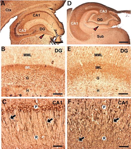 Light microscopic localization of dysbindin-1 in HF of DBA/2J mice ( A – C ) and macaque monkeys ( D – F ). Antigen was localized in mice with the anti-mouse antibody M10FLA and in macaques with the anti-human antibody Hdys746. The neuropil immunoreactivity in DGiml is almost exclusively diffuse, whereas that in CA1 is a mixture of diffuse and dendritic immunoreactivity. The latter is indicated by arrows. Immunoreactivity in nuclei of the macaque CA1 pyramidal cells, which are less aggregated than in mice, was not blocked by pre-adsorption test and is thus non-specific. MML, middle molecular layer of the DG; P and R, strata pyramidal and radiatum of CA1, respectively. For other abbreviations, see Figs 2 and 3 . Scale bar in A=300 µm; those in B and C=50 µm; that in D=1 mm; E and F=100 µm.