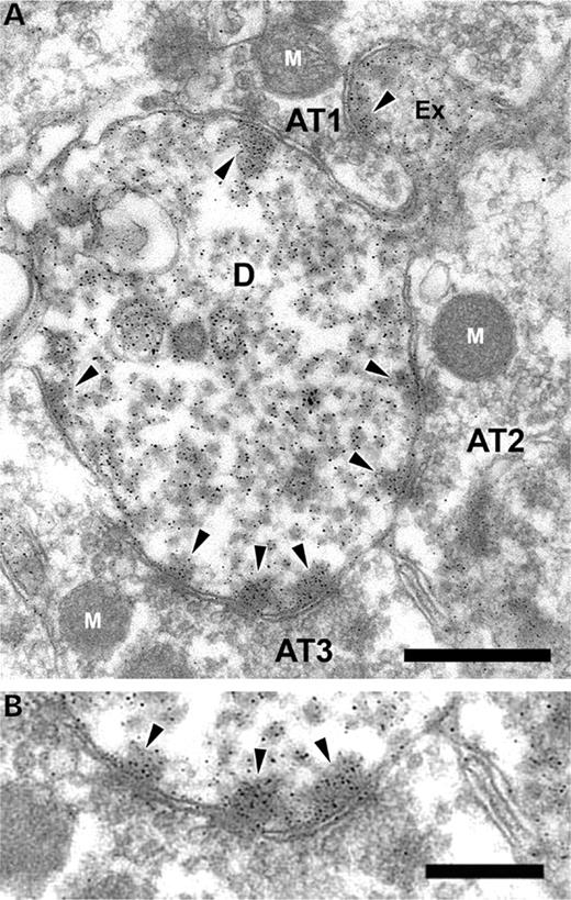 Postsynaptic localization of dysbindin-1 in dentate mossy neurons of the DBA/2J mouse. Immunolabeling with PA3111A was visualized with silver–gold treatment of DAB reaction product. ( A ) A dendrite with labeled microtubules giving rise to a thorny excrescence (Ex) postsynaptic to a large mossy terminal (AT1) characteristic of dentate mossy cells. Labeled PSDs identified by arrowheads are seen on the excrescence, as well as on the shaft of the dendrite opposite unlabeled axon terminals (AT). AT1 and AT2 may be part of a single terminal. ( B ) Higher magnification view of PSDs seen in the adjoining panel. Scale bar in A=500 nm; B=250 nm.