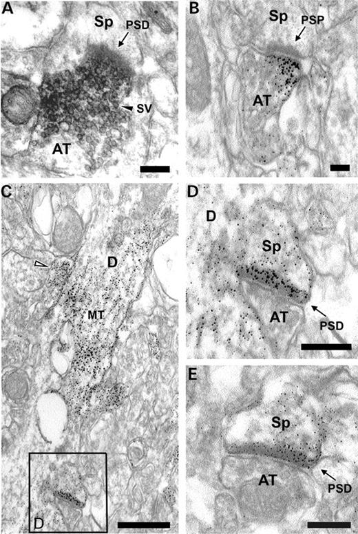 Pre- and post-synaptic localization of dysbindin-1 in CA1 stratum radiatum of macaque monkeys ( A ) and DBA/2J mice ( B – E ). Immunolabeling with PA3111A was visualized with DAB reaction product treated with nickel in A and with silver–gold in B–E. Labeled clusters of synaptic vesicles (SV) in axon terminals (AT) on spines (Sp) with unlabeled PSDs are seen in A and B. Microtubules (MT) in the apical dendrite (D) of a pyramidal neuron are prominently labeled in C, the boxed area of which contains a labeled spine shown at higher magnification in D. The empty arrowhead in C points to a potential AT forming a symmetric synapse on the shaft of a pyramidal cell apical dendrite. Another spine with labeled PSD is seen in E. Scale bars in A, B, D and E=100 nm; that in C=500 nm.