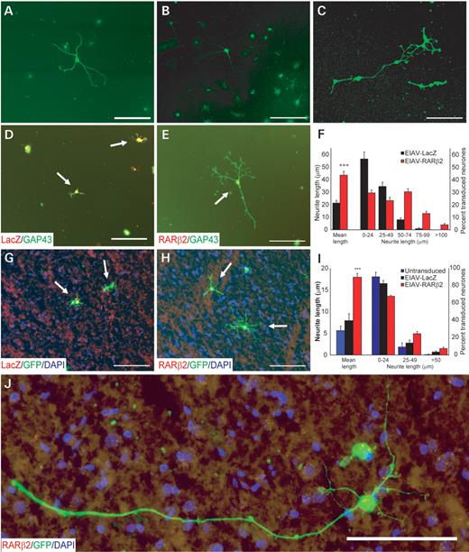 EIAV-RARβ2 promoted neurite outgrowth in adult cortical neurones in vitro. Adult cortical cultures were immunostained for neuronal markers such as MAP2 (A), NeuN (B) and βIII tubulin (C) in order to verify that cultures were enriched with neurones. Neurite outgrowth from cortical neurones was assessed on poly-l-lysine (D–F) or on cortical sections that provide a non-permissive substrate (G–J). Adult cortical neurones transduced with either control EIAV-LacZ (D and G) or EIAV-RARβ2 (E and H) were identified by mouse anti-β-galactosidase (1:300, Promega) or mouse anti-RARβ (1:200, Chemicon), indicated in red, respectively. Neurite outgrowth was detected, in green, by rabbit anti-GAP 43 (D and E; 1:1000, Chemicon), a regeneration marker. (F) In cultures on poly-l-lysine, measurement of neurite lengths from transduced neurones indicated that the average longest neurite from EIAV-RARβ2-transduced neurones was longer compared with control EIAV-LacZ-transduced neurones, with an increase in percentage of transduced neurones with neurite lengths greater than 50 µm. (I) EIAV-RARβ2-transduced neurones also extended longer neurites on cortical cryosections compared with EIAV-LacZ neurones and control-untreated neurones. (I) The percentage of transduced neurones with neurite lengths greater than 25 µm was also increased in EIAV-RARβ2 cultures, with long neurites observed from a few neurones (J). Results are the mean±SEM of at least 150 neurones per experiment, and from three independent experiments. Scale bar: 100 µm.