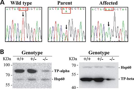 Molecular analyses of the mutant mice. (A) DNA sequence analysis of mouse Hadhb gene. Nucleotide sequences in exon 14 showing that the affected mouse was homozygous for A at the position c.1210 (arrow); parent was T/A and wild-type T/T at the same position. (B) Western blot analysis of HADHA and HADHB protein levels. Forty micrograms of mitochondrial protein from heart of wild-type (+/+), carrier (+/−) and affected (−/−) mice were applied to each lane. Antibodies raised against mouse HADHA, HADHB or HSP 60 (mitochondrial heat shock protein 60) was used; the latter was used as an internal control.
