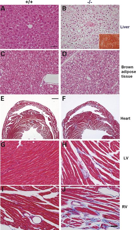 Histopathological analyses of livers, brown adipose tissues and hearts of mice sacrificed at 12 months of age. Livers were stained with hematoxylin and eosin (A and B) and with Oil-Red O (insert in B). Hepatocytes in normal liver showed normal architecture without any sign of hepatic steatosis (A), while those in the affected liver appeared foamy with lipid accumulation and central nuclei (B). Normal brown adipocytes had a considerable volume of cytoplasm with round nuclei located almost centrally (C), while those in affected mice (−/−) contained much larger volume of lipid droplets and peripheral nuclei (D). Hearts were sectioned coronally through the left and right ventricle (E–J). The connective tissue proliferation (multifocal fibrosis) was detected by blue coloration in Masson Trichrome staining. Fibrosis was prominent in myocardium of left ventricle (H), right ventricle (F and J) and septum (F) in the affected heart. Bars=50 µm (A–D and G–J) and 1 mm (E and F).