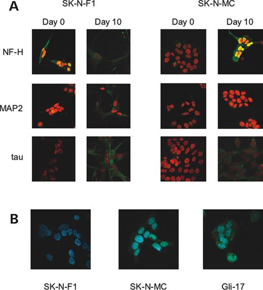 SK-N-F1 and SK-N-MC neuronal differentiation. (A) Immunocytochemistry analysis in undifferentiated and differentiated cells of the expression of neuronal markers NF-H, MAP2 and tau (green), counter-stained with propidium iodide nuclear stain (red). After the 10 day differentiation process both cell lines extend long, neuronal-like processes and express neuronal markers. (B) Immunocytochemistry analysis of the expression of the glial cell marker GFAP (green) counter-stained with the nuclear stain DAPI (blue). Differentiated SK-N-F1 cells do not express GFAP, whereas SK-N-MC cells do, suggesting SK-N-F1 is a better human cell culture model of neuronal gene expression.