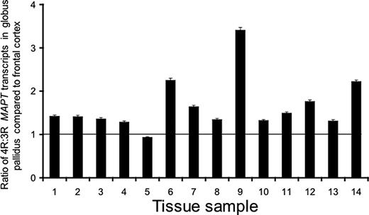 The MAPT 4R : 3R transcript ratio is greater in the globus pallidus than in the frontal cortex in 13 of the 14 (93%) control brains. With only one exception, the ratio of 4R:3R transcripts was significantly higher in the globus pallidus than the frontal cortex (P<0.0001 in each individual brain by one sample t-test), with the ratio of transcripts ranging from 1.3 to 3.5 (mean 1.652, SD 0.618). The frontal cortex and globus pallidus splicing data were normalized to a ratio of one using the control constructs in Figure 1C. A value of 1 indicates that the 4R:3R ratios in the globus pallidus and frontal cortex are equal. For frontal cortex and globus pallidus measurements 16 assays were performed (eight using the forward primer and eight with the reverse primer) to calculate the mean and standard deviation.
