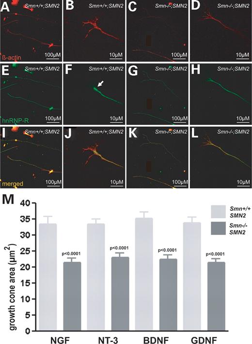 Figure 4. Reduced β-actin content in neurite terminals of isolated Smn-deficient sensory neurons. Dorsal root ganglionic sensory neurons from Smn−/−;SMN2 and Smn+/+;SMN2 embryos were cultured for 24 h, fixed with 4% PFA and stained with antibodies against β-actin (red) and hnRNP-R (green). HnRNP-R and β-actin are homogenously distributed throughout the cell bodies and proximal neurites in wild-type (A, B, E, F, I and J) and Smn-mutant sensory neurons (C, D, G, H, K and L). Staining in the distal parts of Smn-deficient neurites appears weaker. The area of the growth cones of Smn-deficient sensory neurons (black bar) and wild-type controls (grey bar) treated with NT-3, NGF, BDNF and GDNF was determined by staining against β-actin (B, D, J and L), followed by morphological analysis (M). The growth cone area of Smn-deficient sensory neurons in the presence of each survival factor is significantly reduced (P<0.0001).