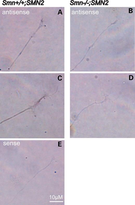 Figure 5. Reduction of actin mRNA in growth cones of Smn-deficient sensory neurons. In situ hybridization of cultured sensory neurons derived from Smn−/−;SMN2 (B and D) and Smn+/+;SMN2 mice with an antisense probe against actin mRNA (A and C). The signal for actin mRNA is reduced in the distal part of the neurites in Smn-deficient sensory neurons (B and D). An actin-sense probe was used as negative control and did not reveal a detectable signal (E).