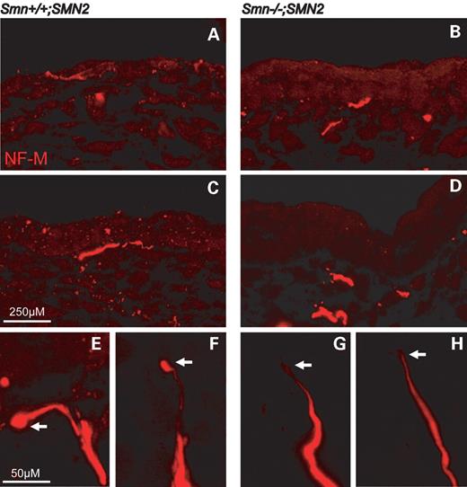 Figure 6. Nerve endings of sensory neurons in footpads from E14-old-Smn-deficient mouse embryos. Cryosections of footpads from Smn-wild-type and Smn-deficient E14 embryos were prepared. Each section was stained with a polyclonal antibody against neurofilament-M (red) and analysed by confocal microscope. Distal nerve endings from Smn-deficient sensory neurons do not reach the outer epidermal layer (B and D) in contrast to sensory nerve endings from control embryos (A and C). Nerve endings of sensory neurons from wild-type embryos were prominent, and the terminals showed a typical globe-like structure (E and F, arrow). In contrast, the nerve endings in Smn−/−;SMN2 embryos were much thinner (G and H, arrow).