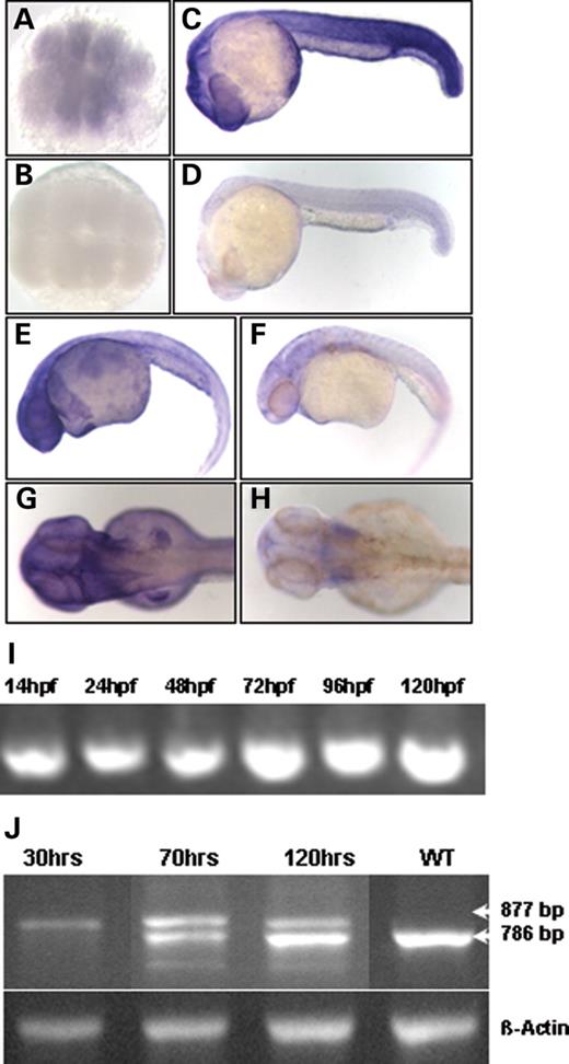 Figure 1. Zebrafish bbs expression is ubiquitous, and splice-block MO results in an altered transcript. Temporal and spatial expression of bbs7 analyzed by WMISH with antisense in (A) 16-cell, (C) 24 h.p.f., (E) 36 h.p.f. and (G) 48 h.p.f. stages and sense controls in (B) 16-cell, (D) 24 h.p.f., (F) 36 d.p.f. and (H) 48 h.p.f. stages. Animal pole view in (A) and (B), lateral view, anterior to the right in (C–H). (I) bbs7 developmental profile by RT–PCR from 14 to 120 h.p.f. (J) RT–PCR products from bbs7 splice-block MO-injected embryos. cDNA libraries were made from a pool of 10 embryos at 30, 70 and 120 h.p.f. The endogenous wild-type band migrates at 786 bp and the altered transcript at 877 bp. Bottom lane shows the β-actin control amplification.