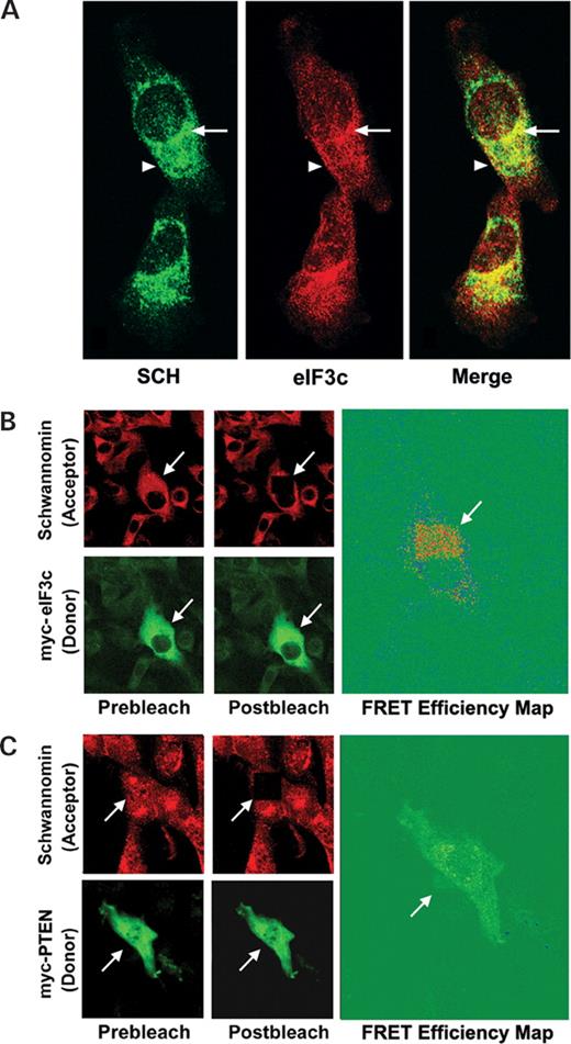 Figure 4. Co-localization of schwannomin and eIF3c in STS26T cells. (A) STS26T cells were immunofluorescently labeled with rabbit anti-eIF3c antibody 2867.2 and chicken anti-schwannomin ab2781. Confocal immunofluorescent microscopy showed that schwannomin and eIF3c co-localized at cytoplasmic, perinuclear (arrow) and plasma membrane structures (arrowhead). (B) FRET of eIF3c and schwannomin in STS26T cells. STS26T cells were transfected with myc-eIF3c and labeled with rabbit anti-schwannomin antibody A-19. Schwannomin and eIF3c localization was detected by secondary labeling with anti-myc-FITC and donkey anti-rabbit-TRITC. The acceptor (TRITC) was photobleached at the position indicated by the arrow by continuos scanning with the 568 nm confocal laser. A FRET efficiency map demonstrated the strongest FRET signal (red) at cytoplasmic puncta. (C) FRET analysis same as in (B) but replacing myc-eIF3c with myc-PTEN as an irrelevant control protein. No FRET between schwannomin and myc-PTEN was observed.