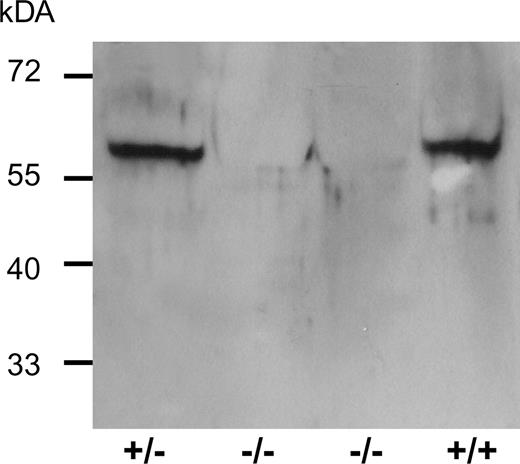 Figure 5. Western blot analysis of cytoskeletal preparations of co-cultured keratinocytes of the mother +/−, the affected children −/− and an unrelated control +/+ showing the absence of K10 protein in the affected children.