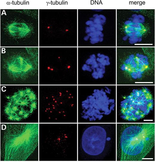 Figure 3. Aberrant mitotic spindles in XRCC3-deficient irs1SF cells. DNA (blue), centrosomes (red) and microtubules (green). (A) Normal mitotic spindle with two centrosomes. (B) Tetrapolar mitotic spindle. (C) Multipolar spindle with >20 active centrosomes. (D) Interphase cell with three centrosomes. Bar=10 µm.
