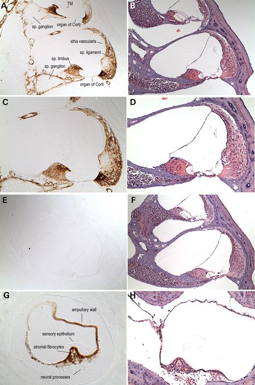 Figure 3. Immunohistochemistry on postnatal (5-month-old) (+/+) (A, C, G) and Coch (−/−) (E) mouse inner ear sections with anti-cochlin. Immunostaining (on the left panels) appears as a reddish brown DAB reaction product; no counterstain was applied on these sections. Serial sections stained with H&E are shown in parallel on the right panels (B, D, F, H). In the (+/+) cochlear duct (A, ×100; C, ×150), prominent cochlin immunostaining is present in fibrocytes and in the ECM throughout the spiral ligament and spiral limbus. Cells lining Rosenthal's canal (surrounding the spiral ganglion) and the channels of the osseous spiral lamina also contain cochlin, whereas the cochlear ganglion cell bodies and the neural processes are negative for cochlin immunostaining. Distinct perivascular rings around blood vessels in the modiolus and throughout the cochlear duct are stained. In contrast, adjacent areas of surrounding bony tissues clearly lack cochlin staining. The structures of the cochlea that show the absence of cochlin expression are the organ of Corti, including the sensory epithelium and tectorial membrane (TM), stria vascularis, Reissner's membrane and spiral ganglion cells. The cochlear duct in the Coch (−/−) mouse (E, ×100) was used as a negative control and lacks any cochlin immunostaining, confirming the specificity of this antibody. In the (+/+) crista of the posterior ampulla in the vestibular labyrinth (G, ×200), intense cochlin staining is observed in the fibrocytes and stroma underlying the sensory epithelium, as well as in the ampullary wall. Neuronal processes within the ampullary stroma as well as the surrounding bone and connective tissues lack any immunostaining. The sensory epithelium is also completely devoid of any cochlin staining, as observed in the cochlear duct.