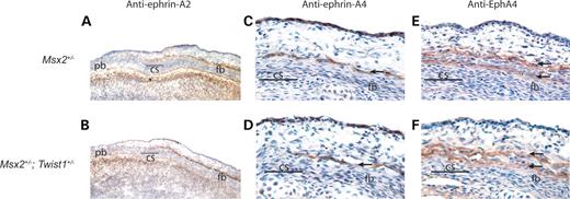 Figure 6. Rescue of ephrin-Eph boundary markers in the Msx2+/−; Twist1+/− coronal suture. Immunohistochemistry for ephrin-A2 on frozen transverse sections shows a layer of expression over the frontal bone, extending to the coronal suture in E14.5 Msx2+/− (A) and Msx2+/−; Twist1+/− (B) embryos. Similarly, ephrin-A4 expression remains unaltered above the frontal bone in Msx2+/− embryos (C, arrow) and is rescued in Msx2+/−; Twist1+/− embryos (D, arrow). Adjacent sections stained using an anti-EphA4 antibody show that expression is maintained in two layers above the frontal bone in Msx2+/− embryos (E, arrows), and this expression pattern is rescued in Msx2+/−; Twist1+/− embryos (F, arrows). cs, coronal suture; fb, frontal bone; pb, parietal bone.