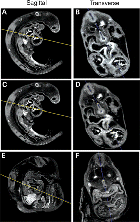 Figure 4. Two-dimensonal digital sections of the point of separation of the foregut. (A–D) show digital sections of the foregut of the CS12 embryo shown in Fig. 3. (E) and (F) show digital sections of the foregut of the CS13 embryo shown in Fig. 3. The left hand images in each case show the saggital section of the same embryo. The yellow line depicts the level of the transverse section shown in the right hand side. In each case the transverse was taken perpendicular to the long axis of the foregut at the point indicated by the yellow line. (B) shows the keyhole-shaped lumen of the foregut at CS12 just rostral to the point of fusion in the same embryo shown in (D). Some evidence of lateral septa can be seen with marked thickening of the ventral endoderm. (F) shows the most rostral point of fusion in the CS13 embryo. Note that the shape and position of this point along the rostrocaudal axis of the embryo is very similar to that in the CS12 embryo.