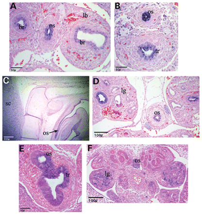 Figure 5. Immunohistochemical analysis of Sox2 in normal and abnormal mouse foregut development. (A) and (B) show Sox2 immunostaining in transverse sections from 11.5 GD mouse embryos. Strong staining is seen in the oesophagus (os) and trachea (tr) with weaker patchy staining in the main bronchi (br). The lung bud proper (lb) is negative for Sox2. (C) shows a saggital section from a 14.5 GD mouse embryo with Sox2 staining visible throughout the foregut endoderm. (D) shows a transverse section through a 14.5 GD mouse embryo demonstrating that Sox2 staining is maintained in the oesophagus (os) and the main bronchi within the lung (lg). (E and F) are transverse sections through Shh−/− mouse embryos at 12.5 GD. (E) shows Sox2 staining within the endoderm of a malformed trachea and oesophagus that have failed to fully divide. This type of malformation is well-described in Shh−/− mice and is analogous to a tracheo-oesophageal fistula in humans. (F) shows an atretic oesophagus that is Sox2 positive and unusual staining within the lung for Sox2.