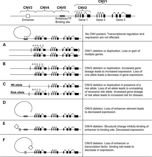 Figure 1. CNV influencing gene dosage and expression and disease. There are a number of mechanisms by which CNVs potentially could have an effect on gene expression and phenotypic traits. Well-documented examples involve regions with multiple genes deleted in microdeletion syndromes and microduplication syndromes (A), where there is a direct correlation between genotype and phenotype. Copy number polymorphisms where a gene is located entirely within a region that varies in copy number (B) have also been described to show a direct correlation between gene copy number and gene expression. Another mechanism by which CNVs may have an influence on disease phenotype is if the remaining copy harbors a risk allele that becomes apparent only in the hemizygous state (C). The opposite scenario may also occur, with an increased number of copies harboring a risk allele, causing a concurrent increase in disease susceptibility. It can also be hypothesized that CNVs may affect gene expression without directly changing the gene copy number. Gains or losses affecting the regulatory elements or promoter regions can also be important contributors to differences in gene expression. This could involve either loss of an element of transcriptional regulation (D and F) or a loss/gain changing the structural properties of DNA inhibiting enhancer interaction, chromatin structure or access of transcription factors to their binding sites (E). Interaction and additive models with any of these scenarios combined or in combination with any type of variation at other loci can be expected to be the cause of more complex genetic traits.