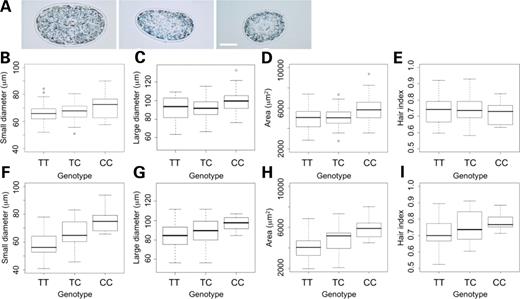 EDAR 1540T/C and hair morphology. (A) Examples of hair cross-sections, bar = 40 µm. (B)–(E) For IDN: (B) small diameter – ANOVA P = 0.032; (C) large diameter – ANOVA P = 0.018; (D) cross-section area – ANOVA P = 5.5 × 10−3; (E) Hair index. (F)–(I) For THM: (F) small diameter – ANOVA P = 5.7 × 10−5; (G) large diameter; (H) cross-section area – ANOVA P = 9.5 × 10−4; (I) hair index.