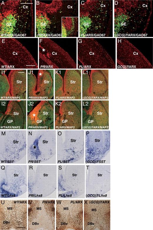  Characterization of the cortex (Cx), striatum (Str) and medial septum (MS) of embryonic and neonatal ArxPR/Y , ArxPL/Y and Arx(GCG)7/Y mice. ( A – D ) Cortical tangential migration in embryos (E12.5) crossbred with GAD67 GFP/+ mice. Arx + (red)/GAD67-GFP + (green) cells in the ArxX/Y embryos began to migrate from the ganglionic eminence (GE) (A), whereas no migration from the GE was seen in the ArxPR/Y embryos (B). Only late migration from the GE along the subventricular zone of the Cx was seen at E14.5 (inset of B). Arx + /GAD67-GFP + cells in ArxPL/Y and Arx(GCG)7/Y embryos migrated normally, although the number of cells was slightly reduced compared with that in the ArxX/Y embryos (C, D). ( E–H ) Arx + cells in the Cx at P0 (E–H). Significantly reduced numbers of Arx + cells were seen in the ArxPR/Y mice, and some of them were clustered at the subplate (F). Arx + cells were only slightly reduced in the ArxPL/Y and Arx(GCG)7/Y mice (G, H). ( I1 – L1 ) Anterior Str and ( I2 – L2 ) posterior Str, ARX (red) and MAP2 (green) expression in the Str at P0. The Arx + and MAP2 − ventricular zone of the anterior Str of ArxPR/Y mice showed increased thickness (* in J1), whereas no increase was seen in ArxPL/Y (K1) or Arx(GCG)7/Y mice (L1). The thickening of the ARX + and MAP2 + ventricular zone was also seen in the posterior Str of ArxPR/Y mice (* in J2), whereas no increase was seen in the ArxPL/Y (K2) and Arx(GCG)7/Y mice (L2). ( M – P ) SST + interneurons in the Str at P0. SST + interneurons were distributed throughout the Str of the ArxX/Y mice (M), whereas they gathered in the thickened ventricular zone of the striatum of ArxPR/Y mice (* in N) and were not present in the mantle zone of the Str (N). On the other hand, a small number of SST + interneurons were seen in the mantle zone of the Str of ArxPL/Y mice compared with ArxX/Y mice (O), whereas most of the SST + interneurons were seen in the ventricular zone of the Str in Arx(GCG)7/Y mice (P). ( Q–T ) Lhx8 expression in the Str at P0. Lhx8 expression was seen throughout the Str of ArxX/Y mice (Q), whereas no expression was seen in ArxPR/Y mice (R). Lhx8 expression was seen in the ventral half of the Str of ArxPL/Y mice (S), whereas no expression was seen in the Arx(GCG)7/Y mice (T). ( U – X ) Arx expression in the MS and vertical limbs of the nucleus of the diagonal band (DBv) at P0. ARX was expressed in the MS and DBv of the ArxX/Y mice (U), but no expression was seen in ArxPR/Y mice (V). Furthermore, significantly reduced Arx expression was observed in the ArxPL/Y and Arx(GCG)7/Y mice (W, X). MGE: medial ganglionic eminence, GP: globus pallidus. Scale bars: A–D, 100 µm; E–H, 250 µm; I1–T, 500 µm; U–X, 500 µm. 