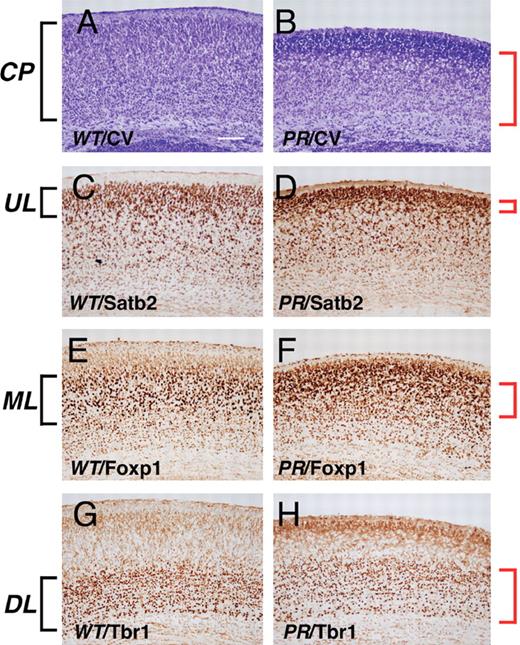  Aberrant cortical layer formation in ArxPR/Y mice. ( A and B ) Cresyl violet staining of the cortical plate of ArxX/Y (A) and ArxPR/Y (B) mice at P0. The thickness of the cortical plate was 85.2 ± 4.8% of wild-type ( P < 0.01, n = 3). ( C and D ) Satb2 imaging of the upper cortical layer of ArxX/Y (C) and ArxPR/Y (D) mice. Satb2 + cells in ArxPR/Y mice were packed together in the uppermost layer, resulting in a thinner Satb2 + upper layer than that of the wild-type. ( E and F ) Foxp1 imaging of the middle cortical layer of ArxX/Y (E) and ArxPR/Y (F) mice. The Foxp1 + middle layer of ArxPR/Y mice was located at the upper side of the cortical plate and exhibited no clear middle layer structure compared to wild-type. ( G and H ) Tbr1 imaging of the deep cortical layer of ArxX/Y (G) and ArxPR/Y (H) mice. The ratio of the Tbr1 + deep layer to the entire cortical plate in ArxPR/Y mice (60.3 ± 5.3%, P < 0.01, n = 3) was slightly higher than that of ArxX/Y mice (48.3 ± 3.8%, P < 0.01, n = 3). CP, cortical plate; UL, upper layer; ML, middle layer; DL, down layer. Scale bars: A–H, 100 µm. 