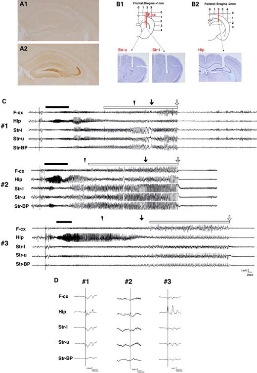  Presentation of seizures in Arx(GCG)7/Y mice. ( A1 and A2 ) Ectopic NPY expression in mossy fibers of the dentate gyrus. Before seizure (A1), after seizure (A2). ( B1 and B2 ) Diagrams of the electrode configuration superimposed on a coronal section of the brain. Local EEG was simultaneously recorded from the striatum (B1) and hippocampus (B2), together with the ipsilateral frontal EEG (B1). The recording sites were histologically verified in the cresyl violet staining sections. ( C ) Ictal EEG activity in three Arx(GCG)7/Y mice (#1, #2, #3). The seizure started (dotted line) simultaneously in the hippocampus, frontal cortex and striatum, followed by diffuse spike bursts. Next, 20–30 Hz spike bursts with waxing and waning appeared in the hippocampus (bar). Then there were continuous bursts of very high-voltage spikes (open bar) in the striatum, which abruptly changed into a long-lasting low-voltage activity with synchronous rhythmic theta waves. All seizures started with limb trembling that progressed to tonic clonic seizures (closed triangle), running fits (arrow) and complete loss of postural control and movement (open arrow). ( D ) Examples of EEG data at the beginning of a seizure in three Arx(GCG)7/Y mice (#1, #2, #3). The first spikes are simultaneously seen in the frontal cortex, hippocampus and striatum. F-cx, frontal cortex; Hip, hippocampus; Str-l, lower electrode in the striatum; Str-u, upper electrode in the striatum; Str-BP, bipolar in the striatum. 